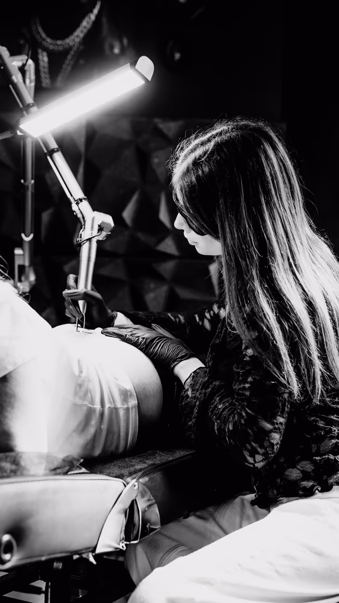 laserowe usuwanie tatuażu warszawa (4)