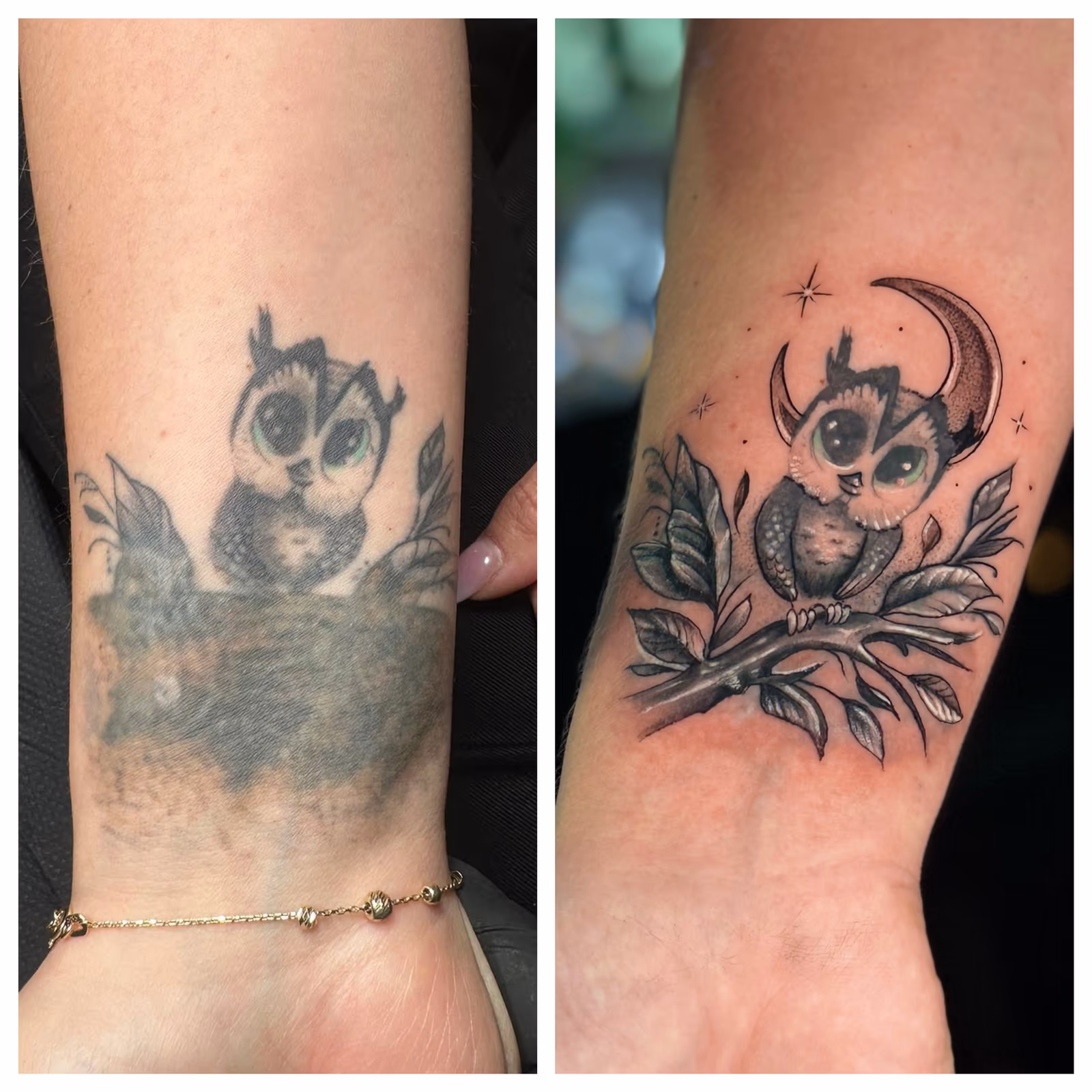 czy można tatuować blizny