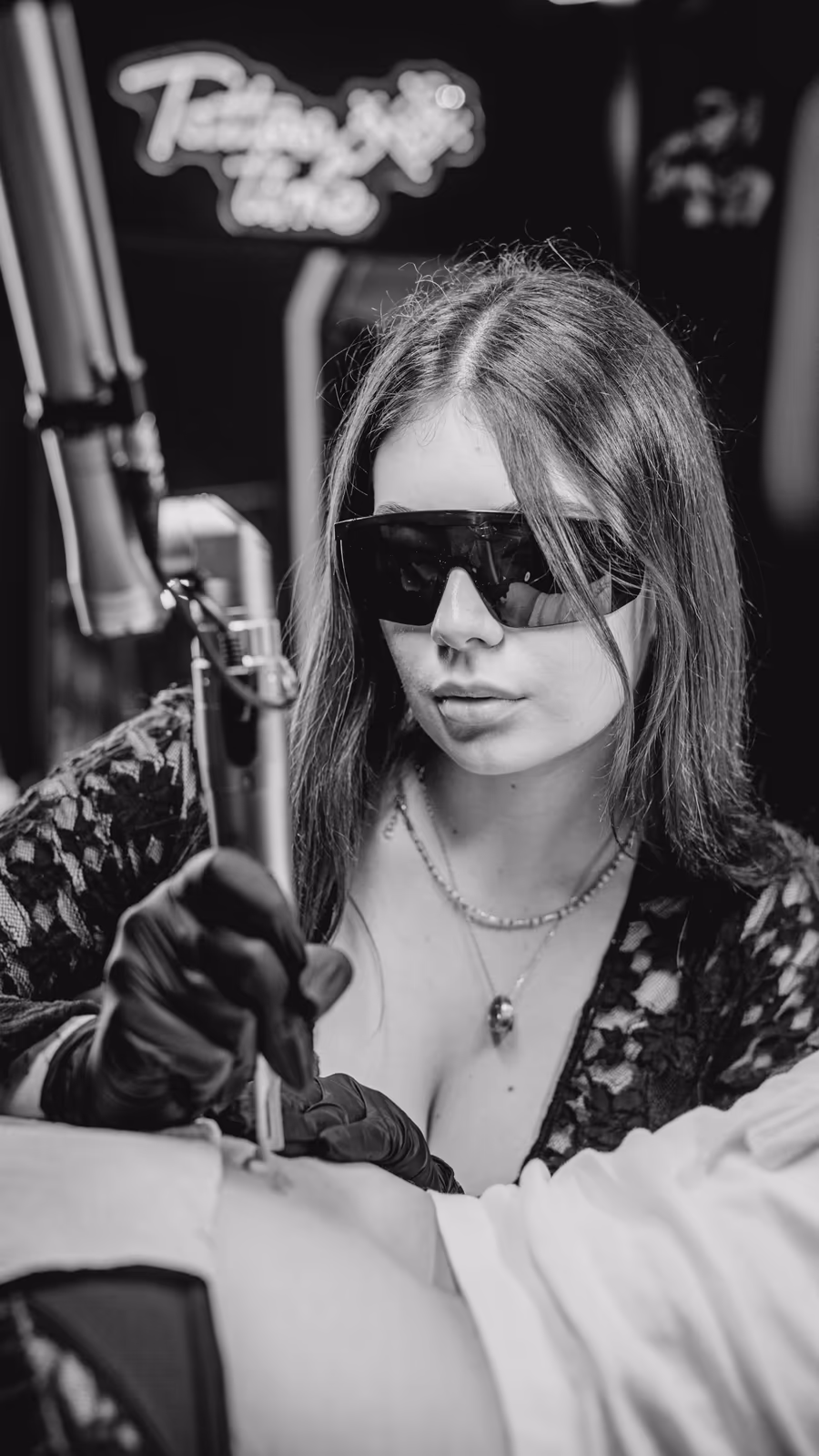 ile kosztuje laserowe usuwanie tatuażu